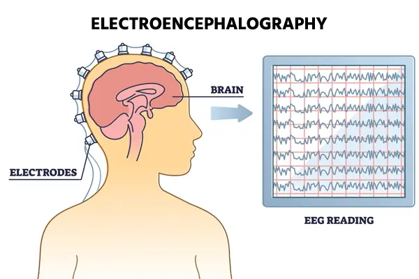 EEG