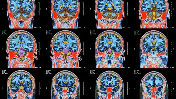 deep learning for medical image analysis
